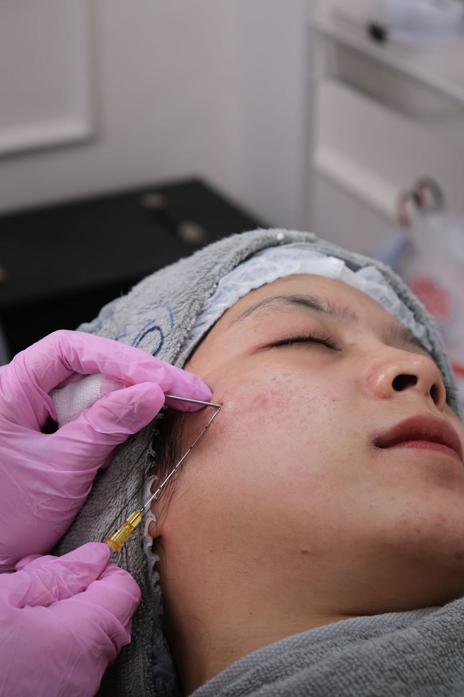 Close-up of a precise skin treatment
